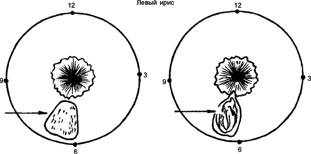 Целебная натуротерапия