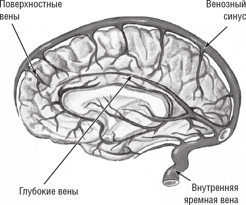 Хрупкий мозг. Инсульту не быть?