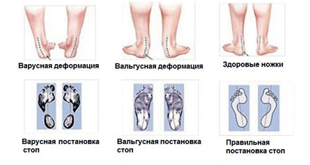 Подология понятно. Важен каждый шаг. Справочник по проблемам подологии для клиентов и мастеров эстетики