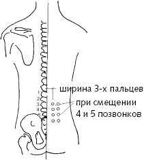 Китайский императорский массаж. Лечение 100 болезней с помощью банок. Большой атлас зон исцеления