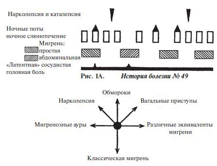 Мигрень