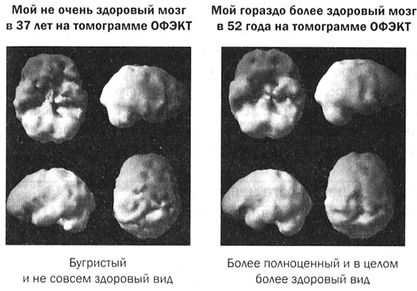 Мозг против лишнего веса