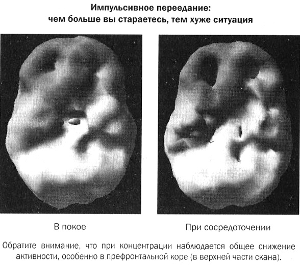 Мозг против лишнего веса