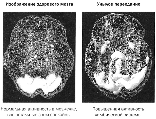 Мозг против лишнего веса