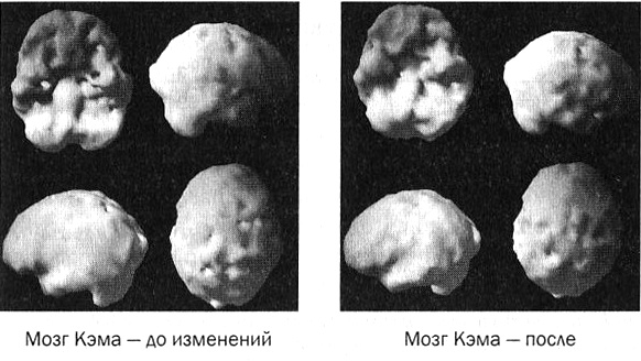 Мозг против лишнего веса