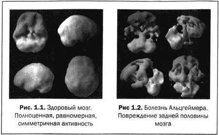 Великолепный мозг в любом возрасте