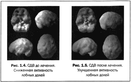 Великолепный мозг в любом возрасте