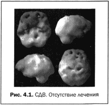 Великолепный мозг в любом возрасте