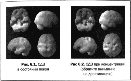 Великолепный мозг в любом возрасте