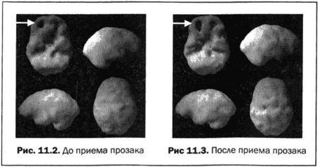 Великолепный мозг в любом возрасте