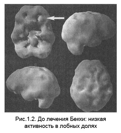 Измени свой мозг - изменится и тело!