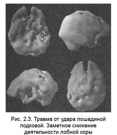 Измени свой мозг - изменится и тело!