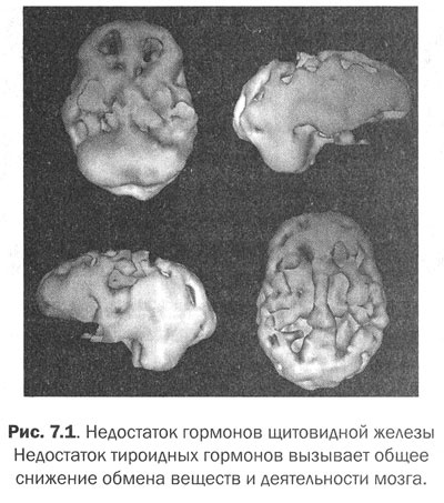 Измени свой мозг - изменится и тело!