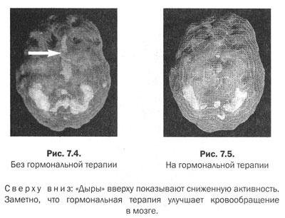 Измени свой мозг - изменится и тело!