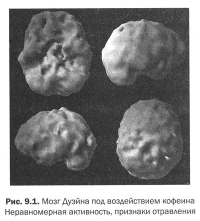 Измени свой мозг - изменится и тело!