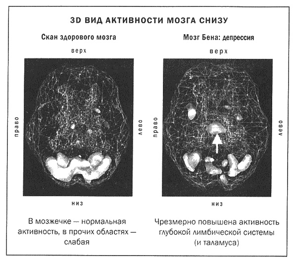 Мозг и душа. Новые открытия о влиянии мозга на характер, чувства, эмоции