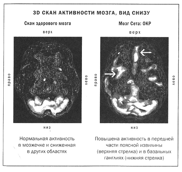 Мозг и душа. Новые открытия о влиянии мозга на характер, чувства, эмоции