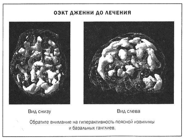 Мозг и душа. Новые открытия о влиянии мозга на характер, чувства, эмоции