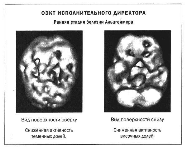 Мозг и душа. Новые открытия о влиянии мозга на характер, чувства, эмоции