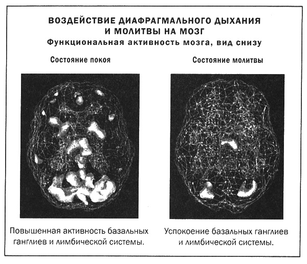 Мозг и душа. Новые открытия о влиянии мозга на характер, чувства, эмоции