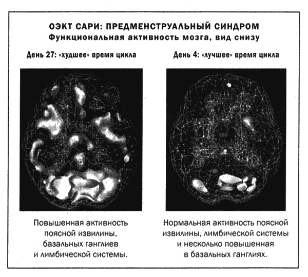 Мозг и душа. Новые открытия о влиянии мозга на характер, чувства, эмоции