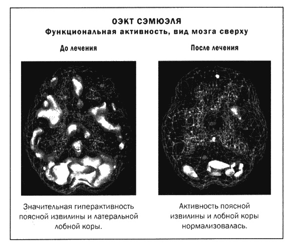 Мозг и душа. Новые открытия о влиянии мозга на характер, чувства, эмоции