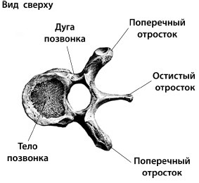 Лечим спину от остеохондроза