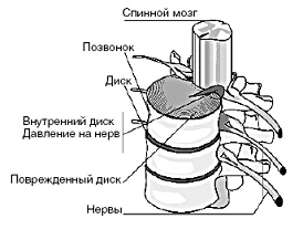 Мощная сила в борьбе с болезнями. Гомеопатия