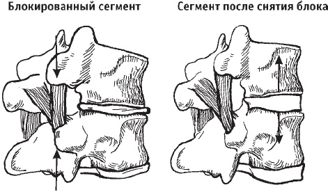 Первая скрипка позвоночника. Революционная методика лечения остеохондроза