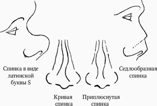 Как распознать преступника