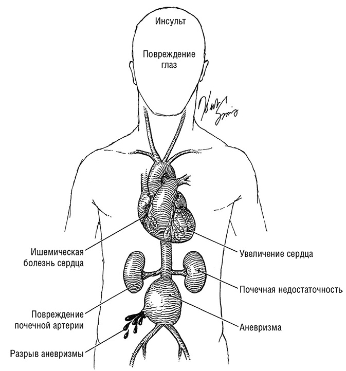 Здоровое сердце. Издание XXI века