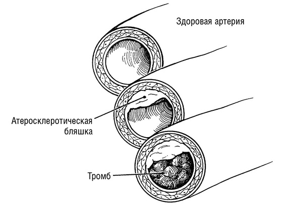 Здоровое сердце. Издание XXI века