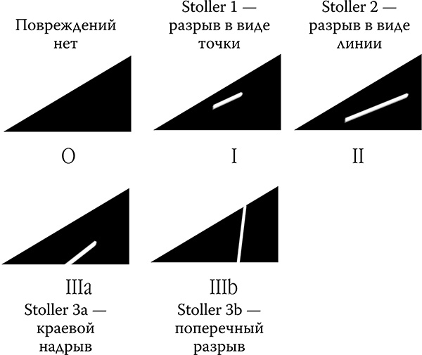 Как лечить спину и суставы