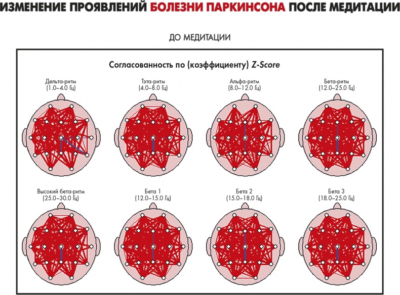 Сам себе плацебо: как использовать силу подсознания для здоровья и процветания