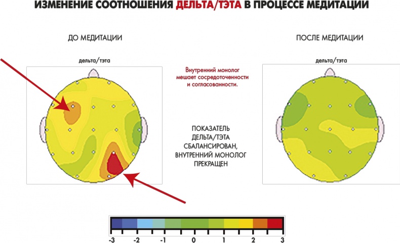 Сам себе плацебо: как использовать силу подсознания для здоровья и процветания