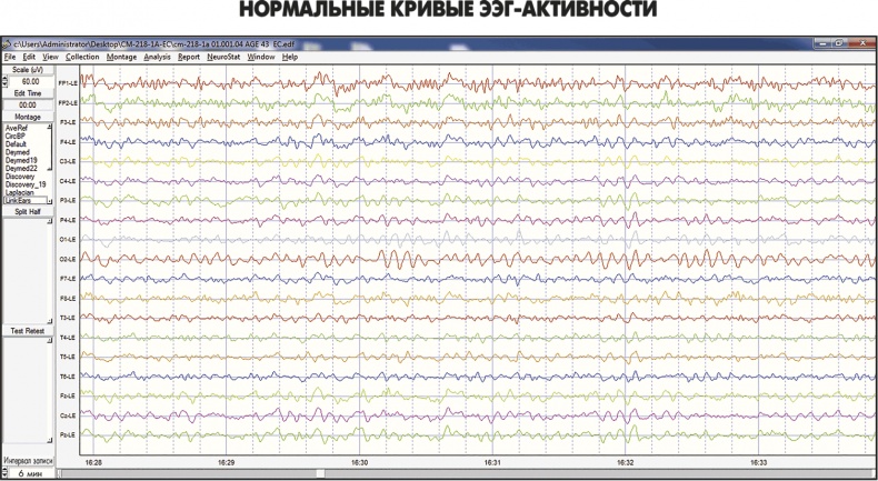 Сам себе плацебо: как использовать силу подсознания для здоровья и процветания