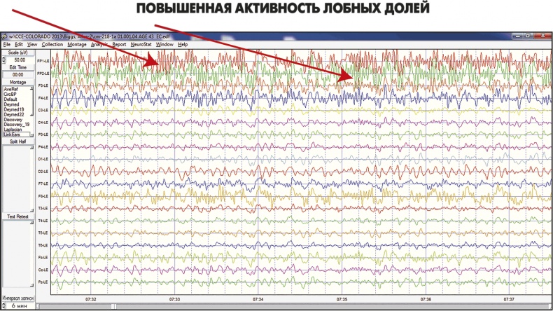 Сам себе плацебо: как использовать силу подсознания для здоровья и процветания