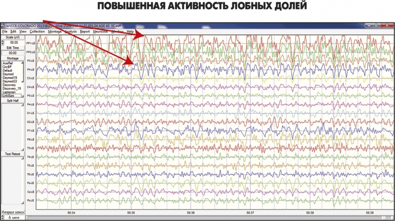 Сам себе плацебо: как использовать силу подсознания для здоровья и процветания