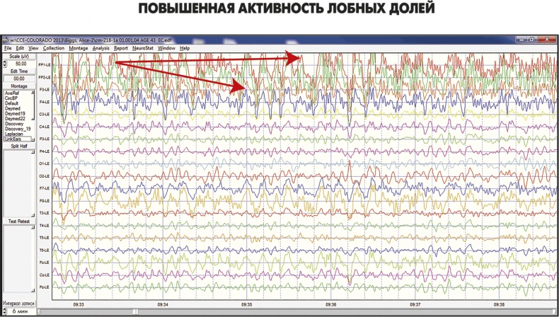 Сам себе плацебо: как использовать силу подсознания для здоровья и процветания