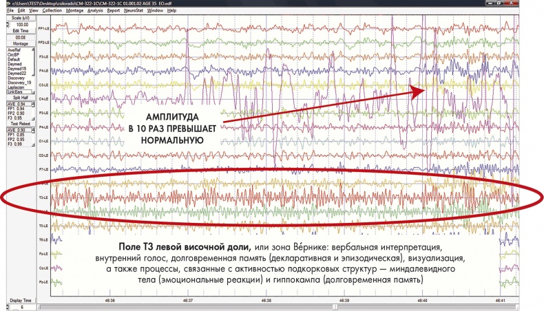 Сам себе плацебо: как использовать силу подсознания для здоровья и процветания