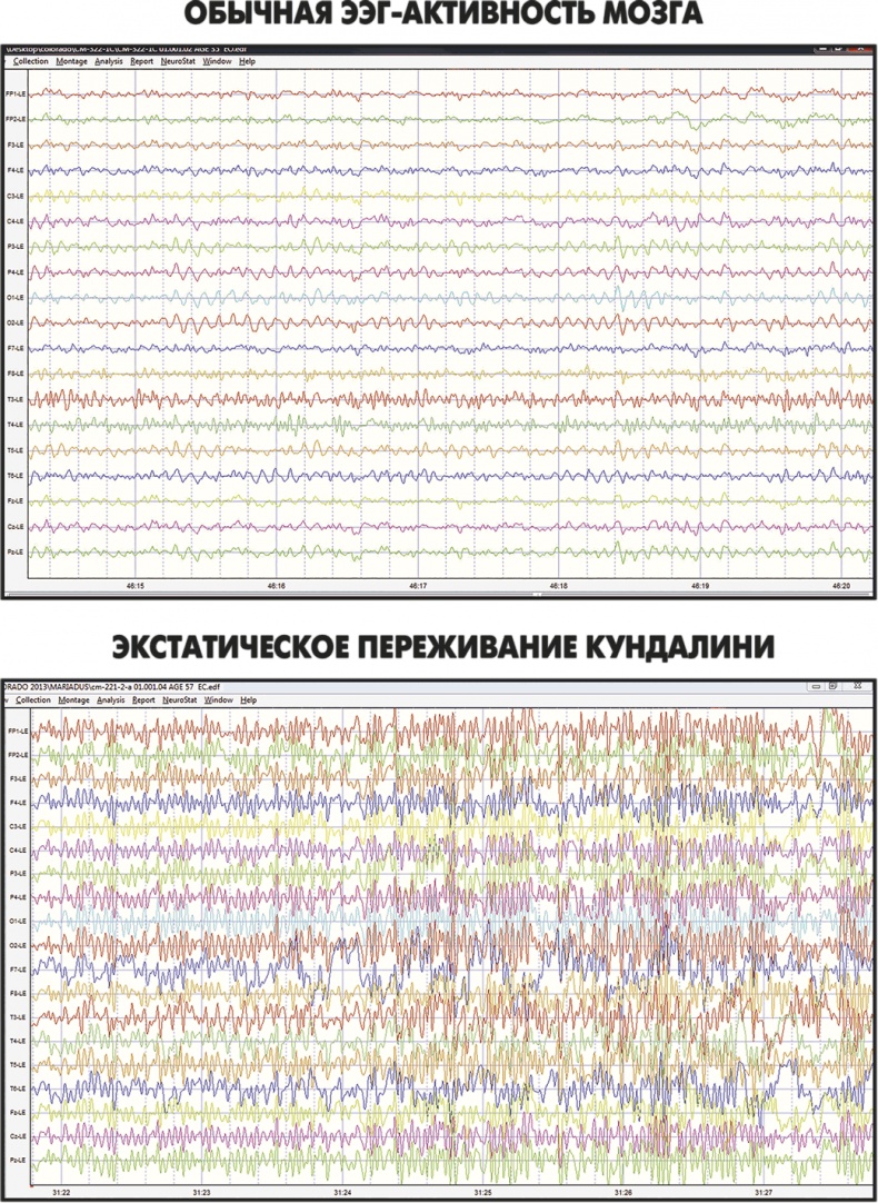 Сам себе плацебо: как использовать силу подсознания для здоровья и процветания