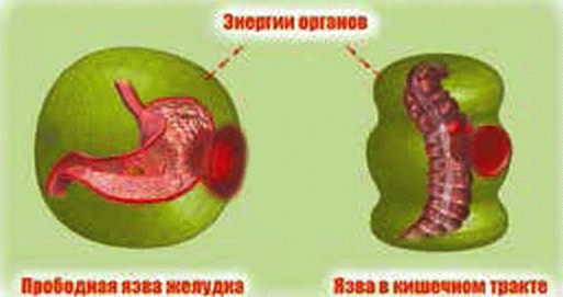 Энергетическое исцеление матрицами