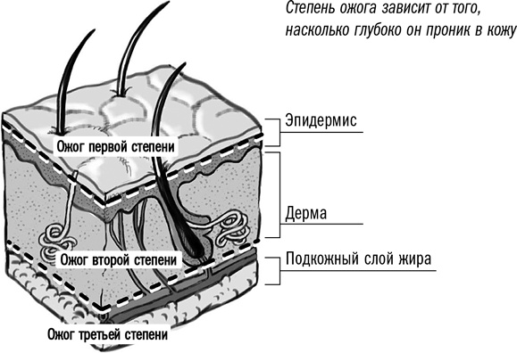 Первая помощь своими руками. Если скорая не спешит