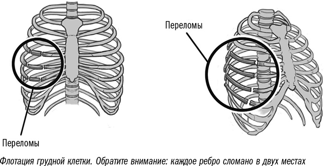 Первая помощь своими руками. Если скорая не спешит