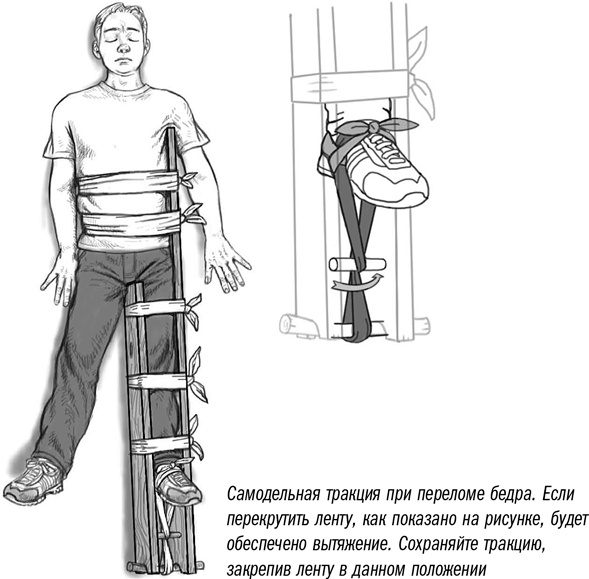 Первая помощь своими руками. Если скорая не спешит