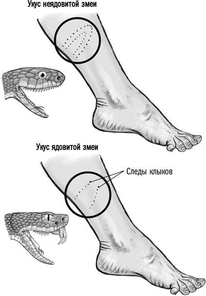 Первая помощь своими руками. Если скорая не спешит