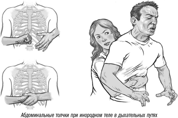 Первая помощь своими руками. Если скорая не спешит