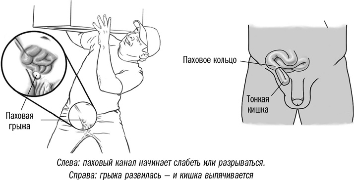 Первая помощь своими руками. Если скорая не спешит