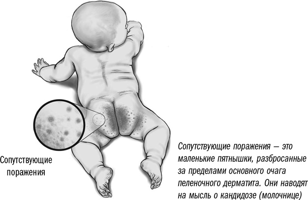 Первая помощь своими руками. Если скорая не спешит