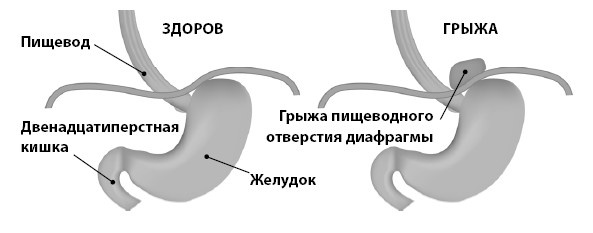 Кишечник с комфортом, желудок без проблем